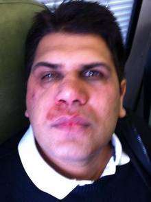 Ramanjit Fohi suffered a broken nose and cheekbone after being attacked as he walked to the supermarket with his wife