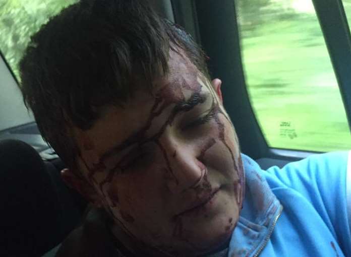 His mum shared details of the attack on Facebook. Picture: Nicki Rogers