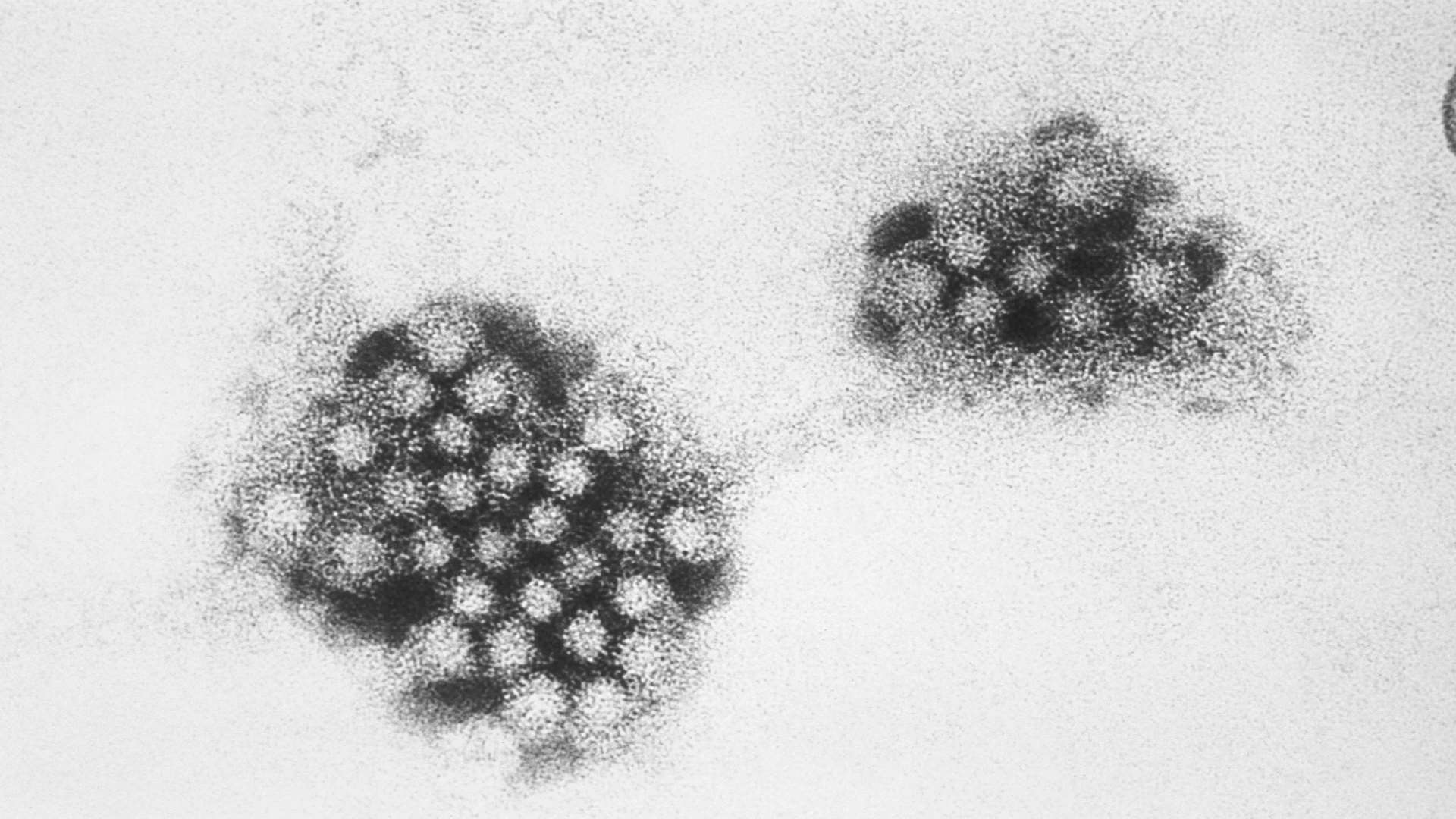 Transmission electron micrograph of Norovirus