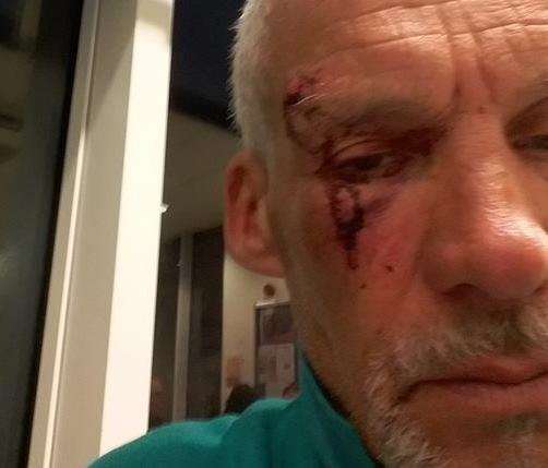 Mark received facial injuries in the attack. Picture: Mark Hills