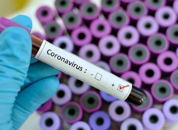 The government is expanding its range of Covid-19 test centres