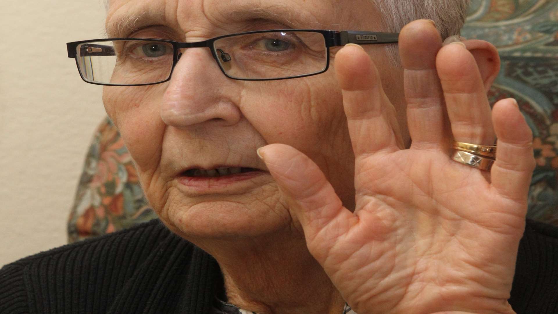 Patricia's finger, four days after her injury. Picture: John Westhrop