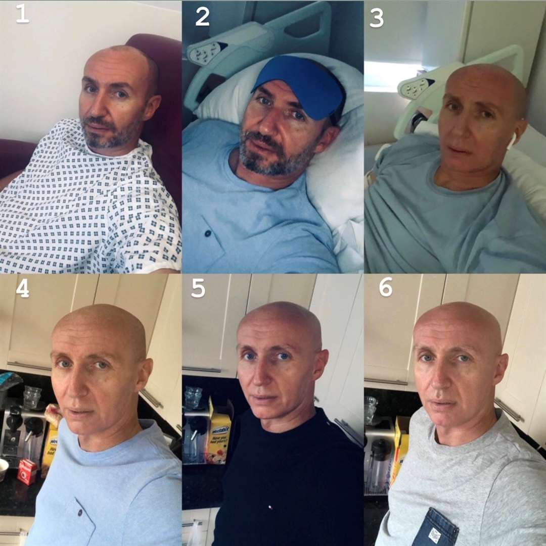 Dan during and after his stem cell transplant. Picture: Dan Anderson