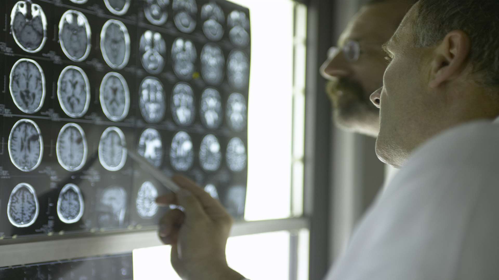 Doctors examine x-rays. File picture: Jochen Sand