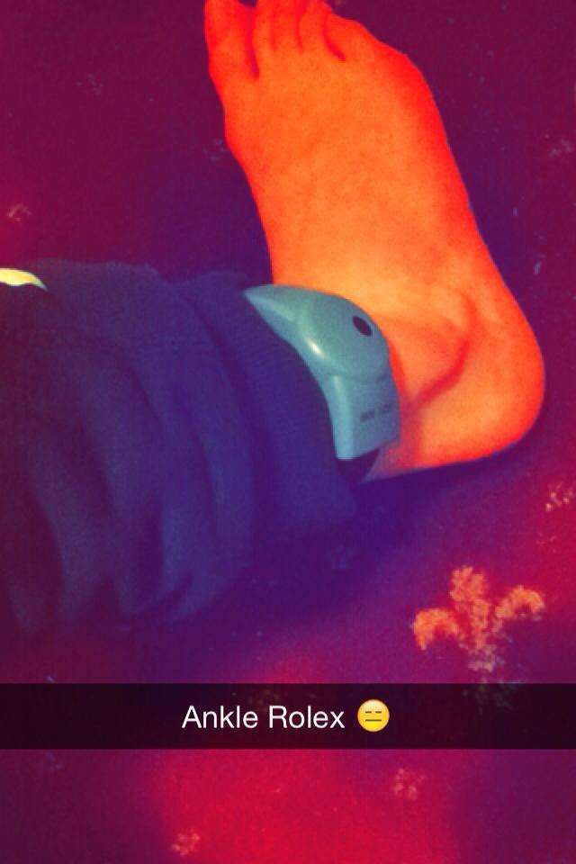 Calvin Saward posted a picture of his electronic tag on Facebook, captioned "Ankle Rolex"