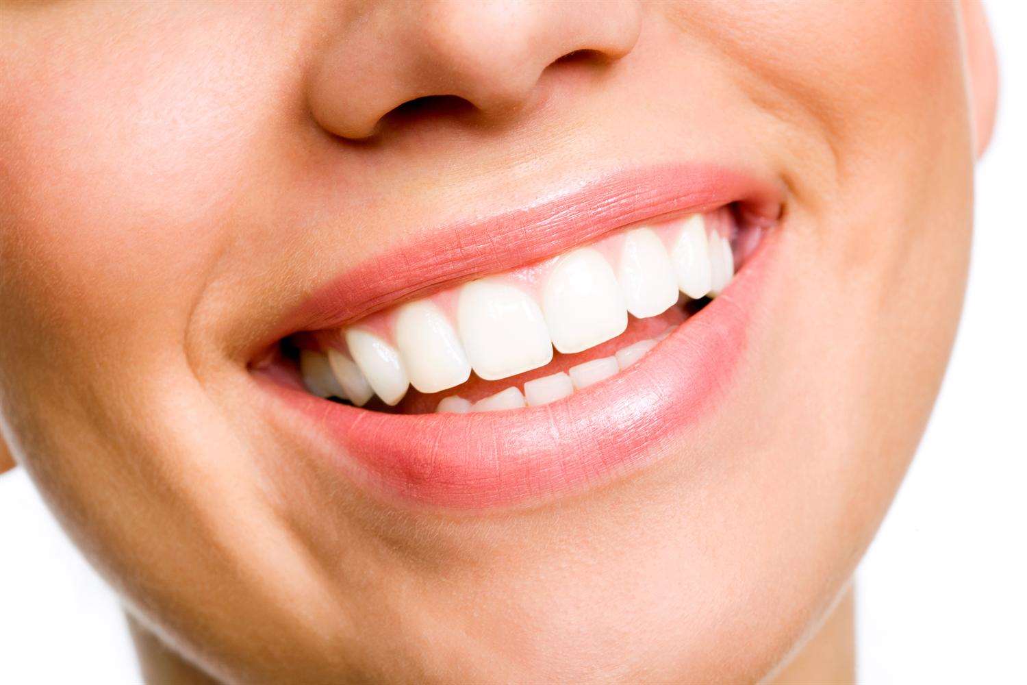 Tooth whitening can only legally be carried out by a registered professional