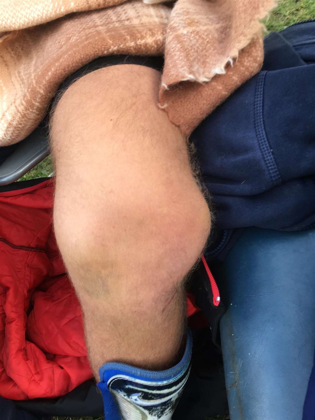 His knee is thought to be dislocated (5190915)