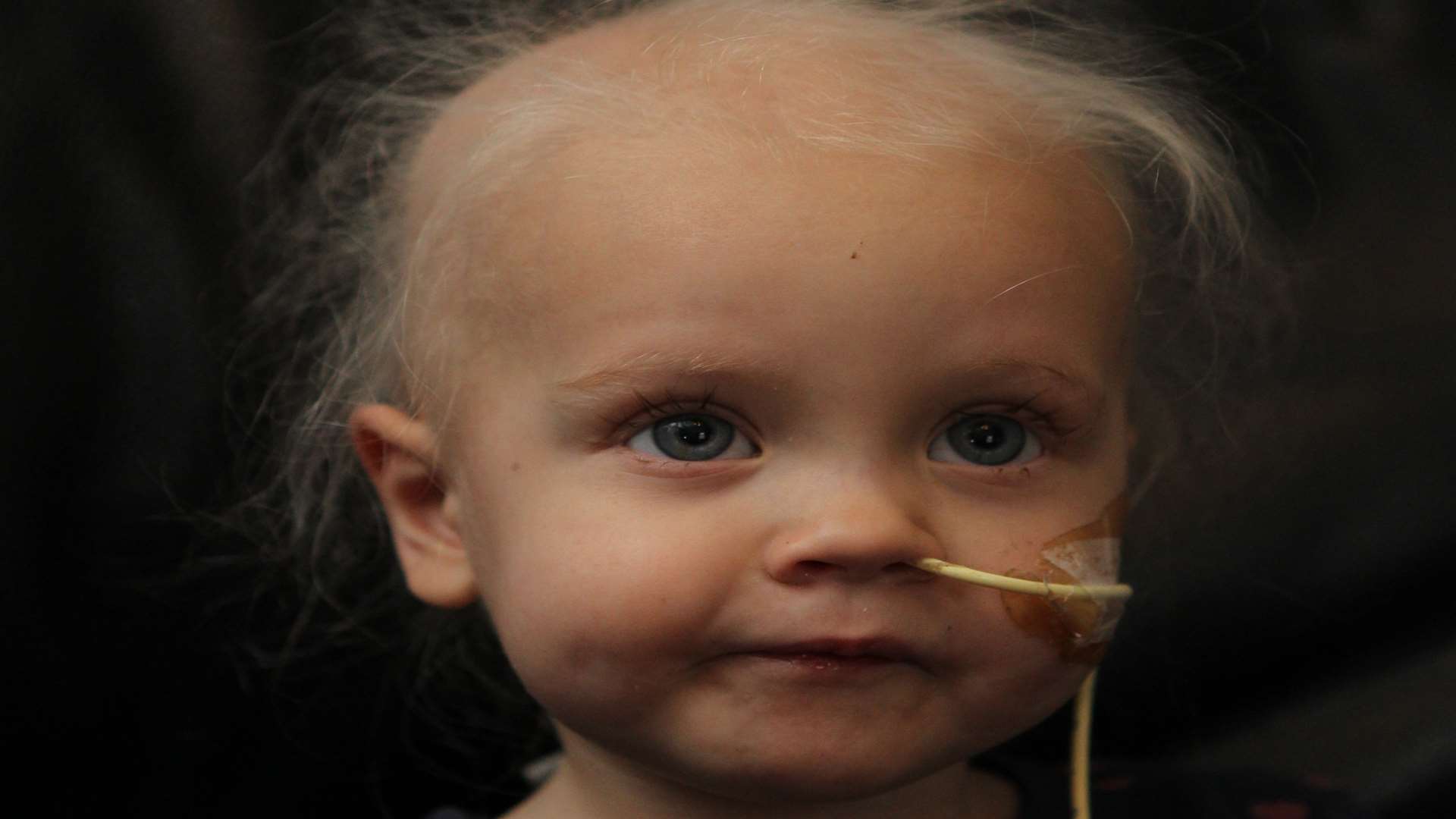 Ruby Young, two, from Rainham has neuroblastoma