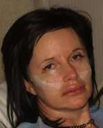 Beverli after her first operation, six weeks on from the London bombings