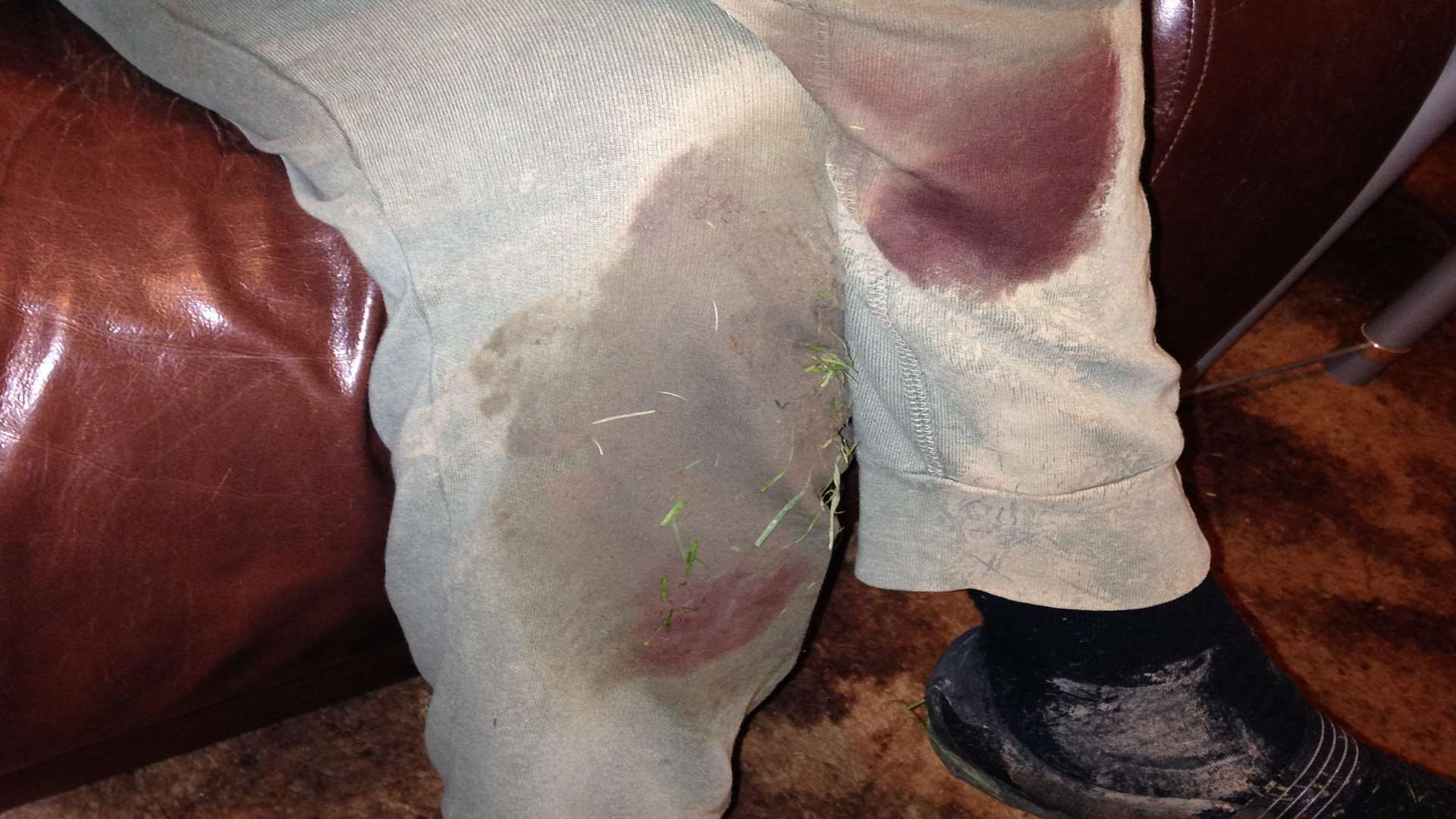 Susan Olsen's blood-stained jeans after defending her puppy from attack