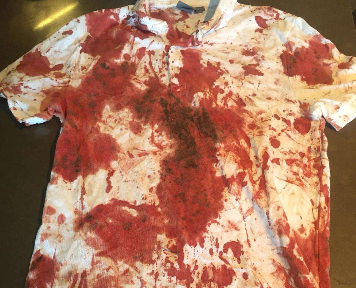 The teenager's blood-stained shirt after the attack