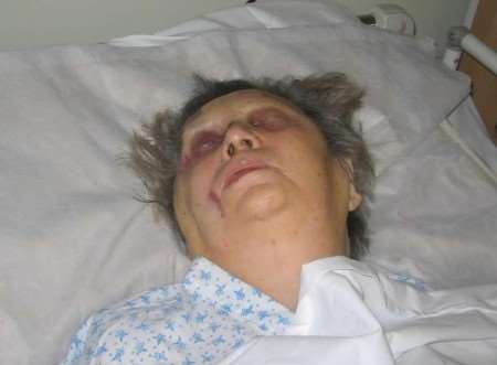 Cicely Hearn in her hospital bed. The picture has been released by her family