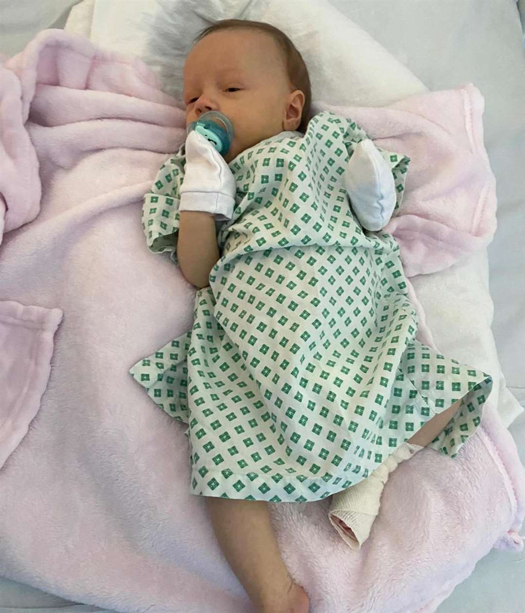 Gracie Harwood was just a few months old when she underwent major surgery at King's College Hospital in London. Photo credit: Rae Harwood