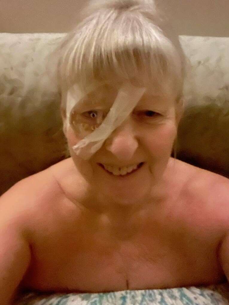 The 67-year-old pictured post eye surgery. Picture: Optegra