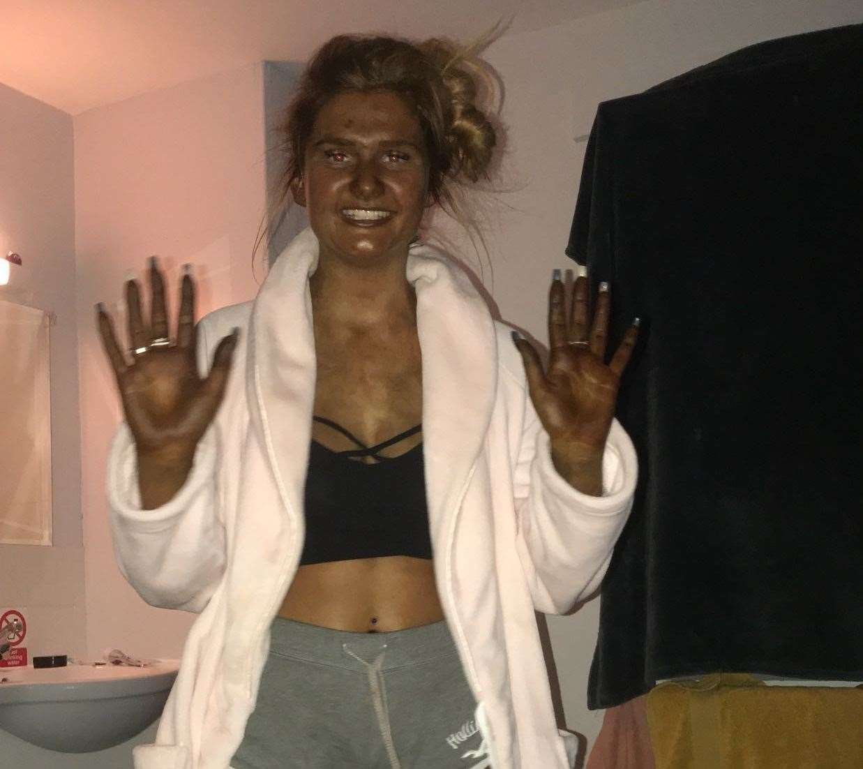 Lilly after slapping fake tan on which turned her green. Picture: Lilly Vigus