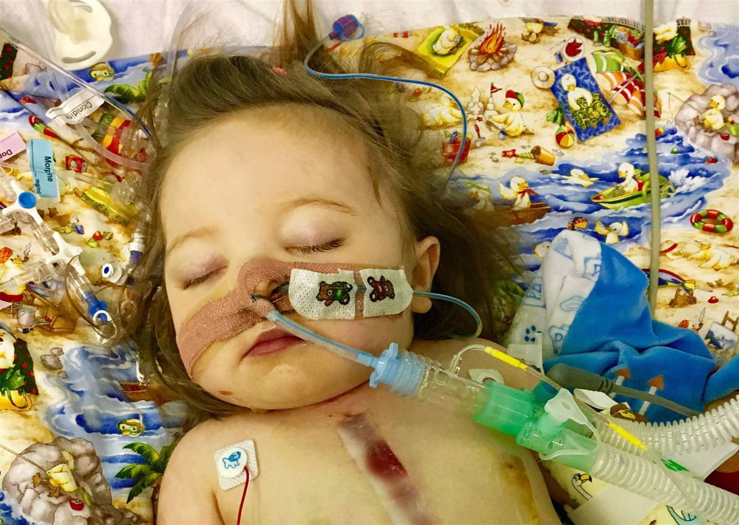Evie was born with multiple life-threatening heart conditions (17387539)