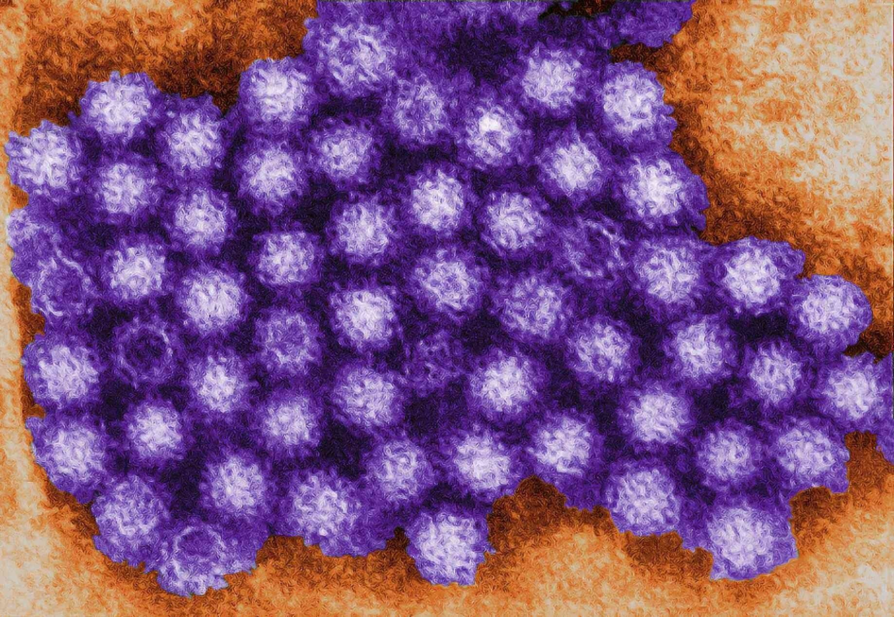 Cases of norovirus are being recorded as highest among people aged 65 and over. Image; Stock photo.