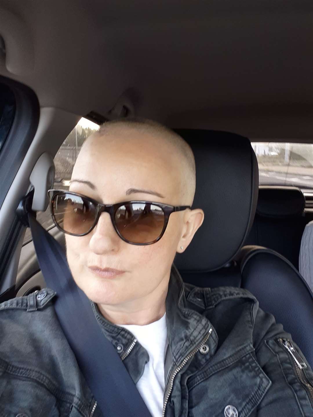 Natalie shaved her head after she began losing her hair