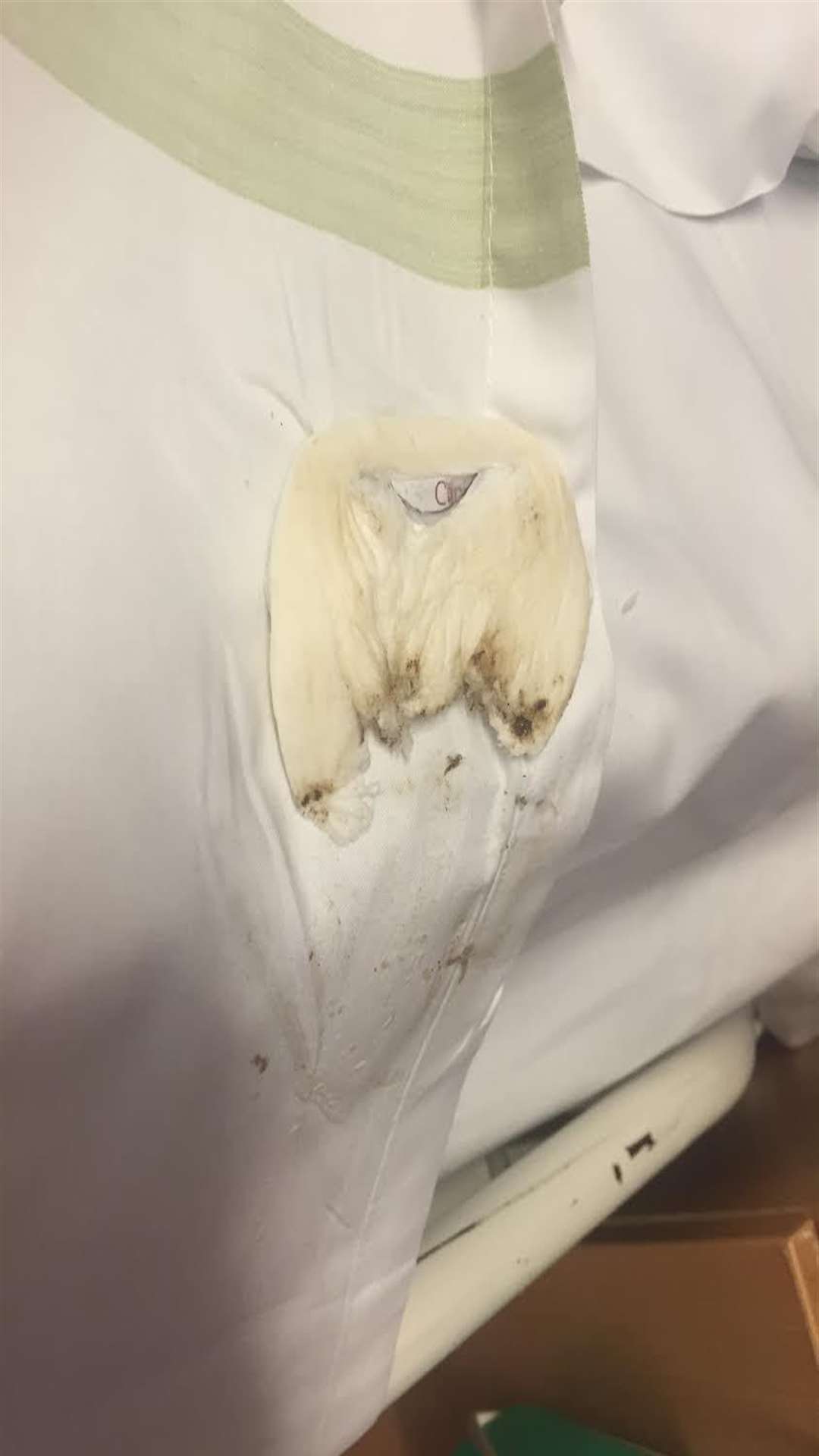 The used dressing Vicki found in her bed sheets