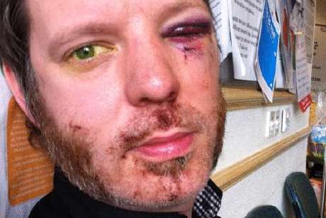 Mr Woolgar was attacked by youths