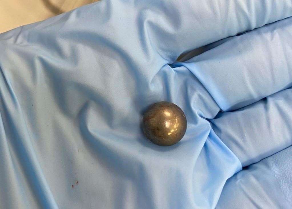 A yob catapulted this ball bearing at Trousers