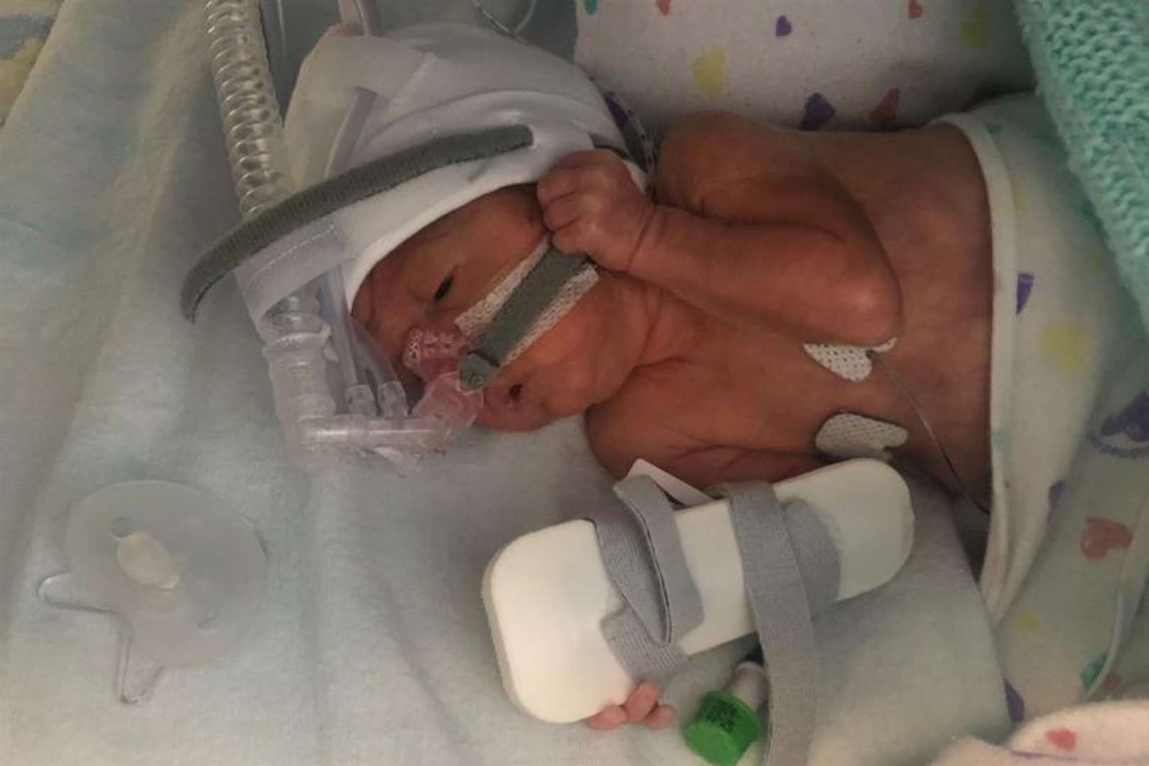 Baby Enzo had to spend 99 days in the NICU