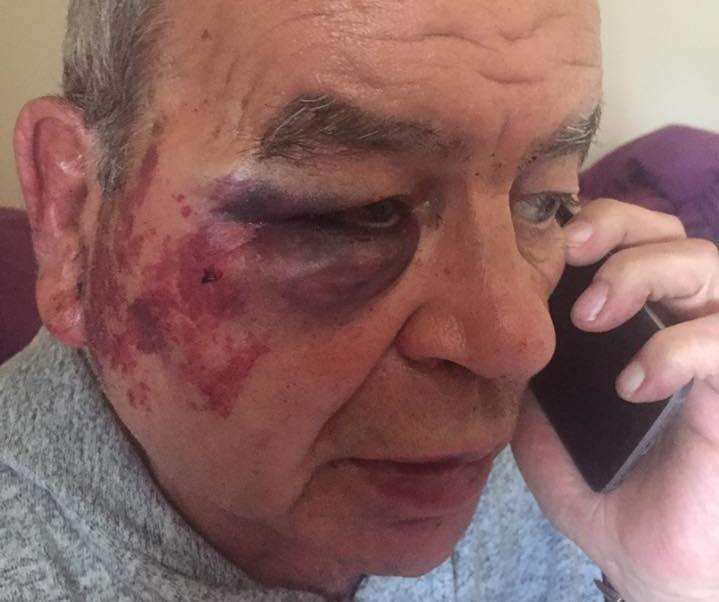 Taxi driver Rob King, 64, from Minster, Sheppey, a week after he was attacked in his cab while parked in Sheerness (sub) (2978558)