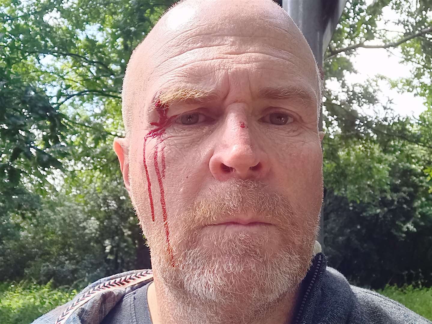 Brian Woodhouse was attacked in front of his two daughters in Ashford Road, Hollingbourne