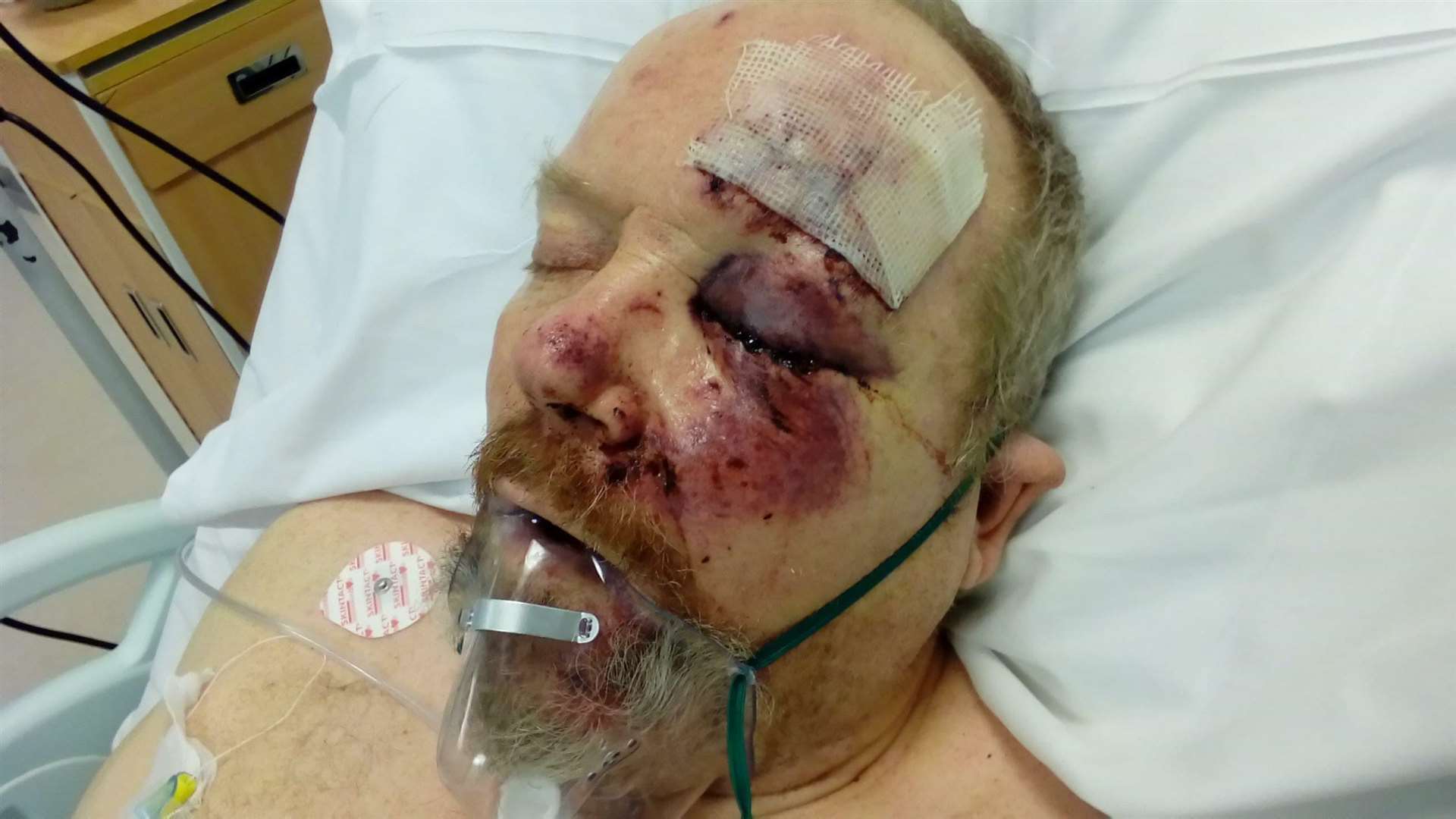 Vince Marsh suffered serious injuries (2886858)