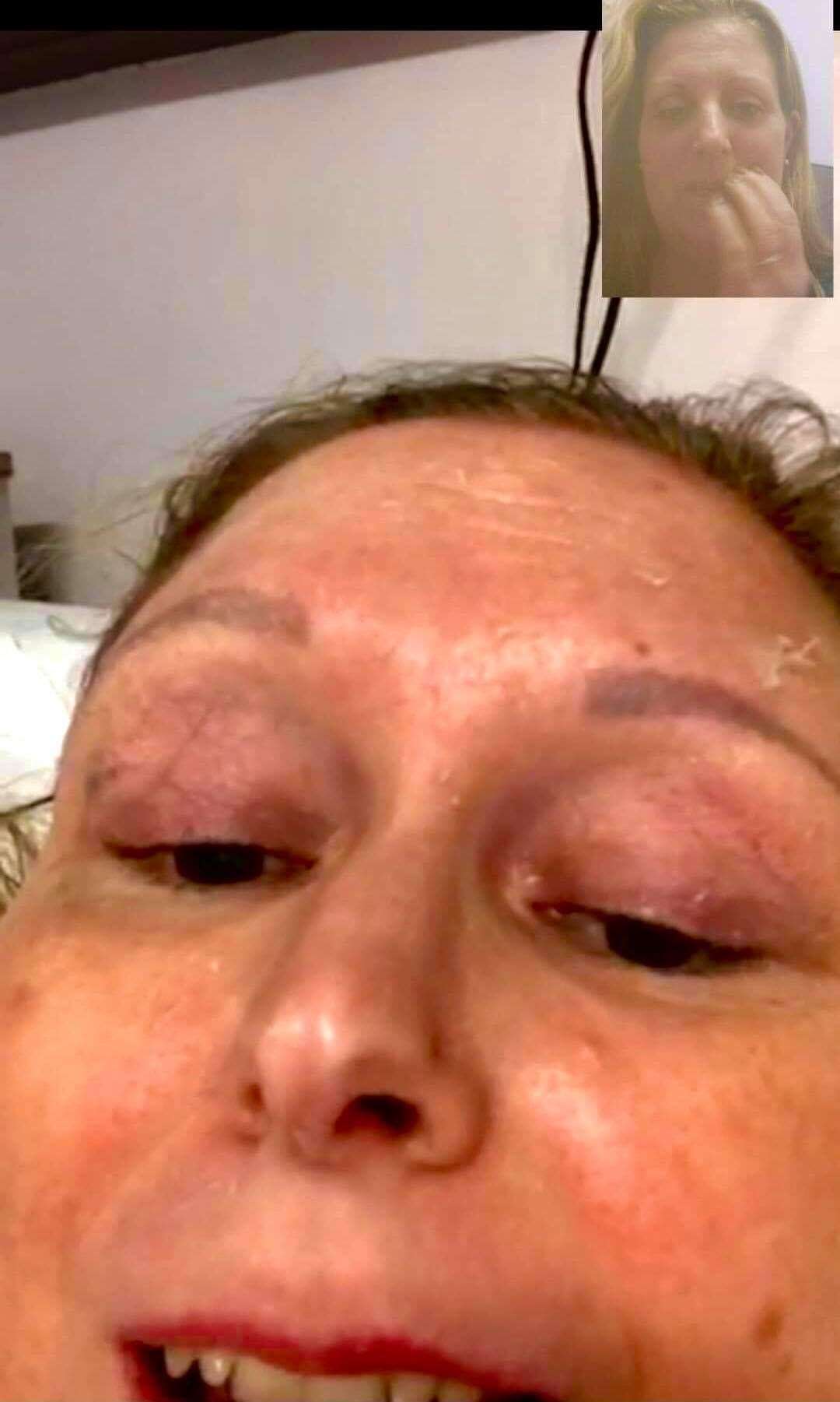 Kelly, video calling her sister, Louise, whilst in hospital with Covid-19