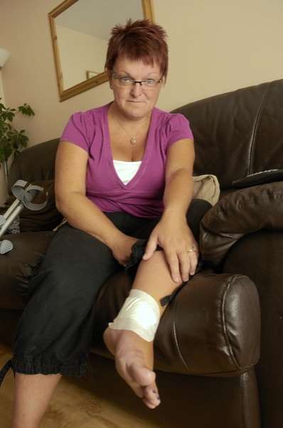 Melanie Miller cut her foot on a discarded barbecue