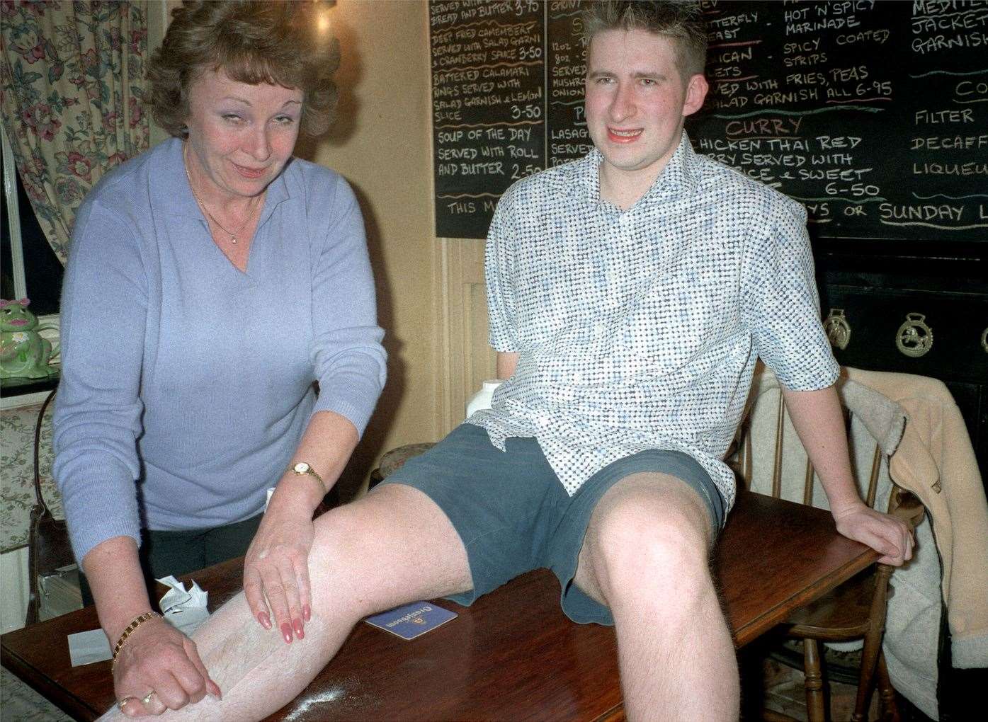 Neil Cackett has his legs waxed by Valerie Wren for charity at The Wheel Inn in 2003
