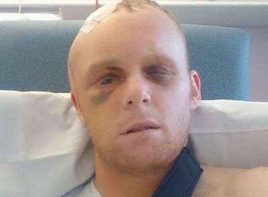 Steven Cutler who fell from scaffolding when working at the Port of Dover