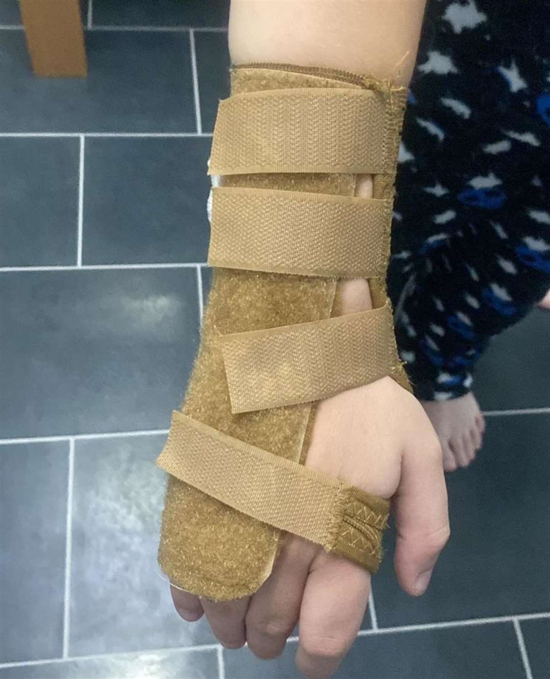 The child is awaiting x ray results but has been given a brace for his wrist in the meantime