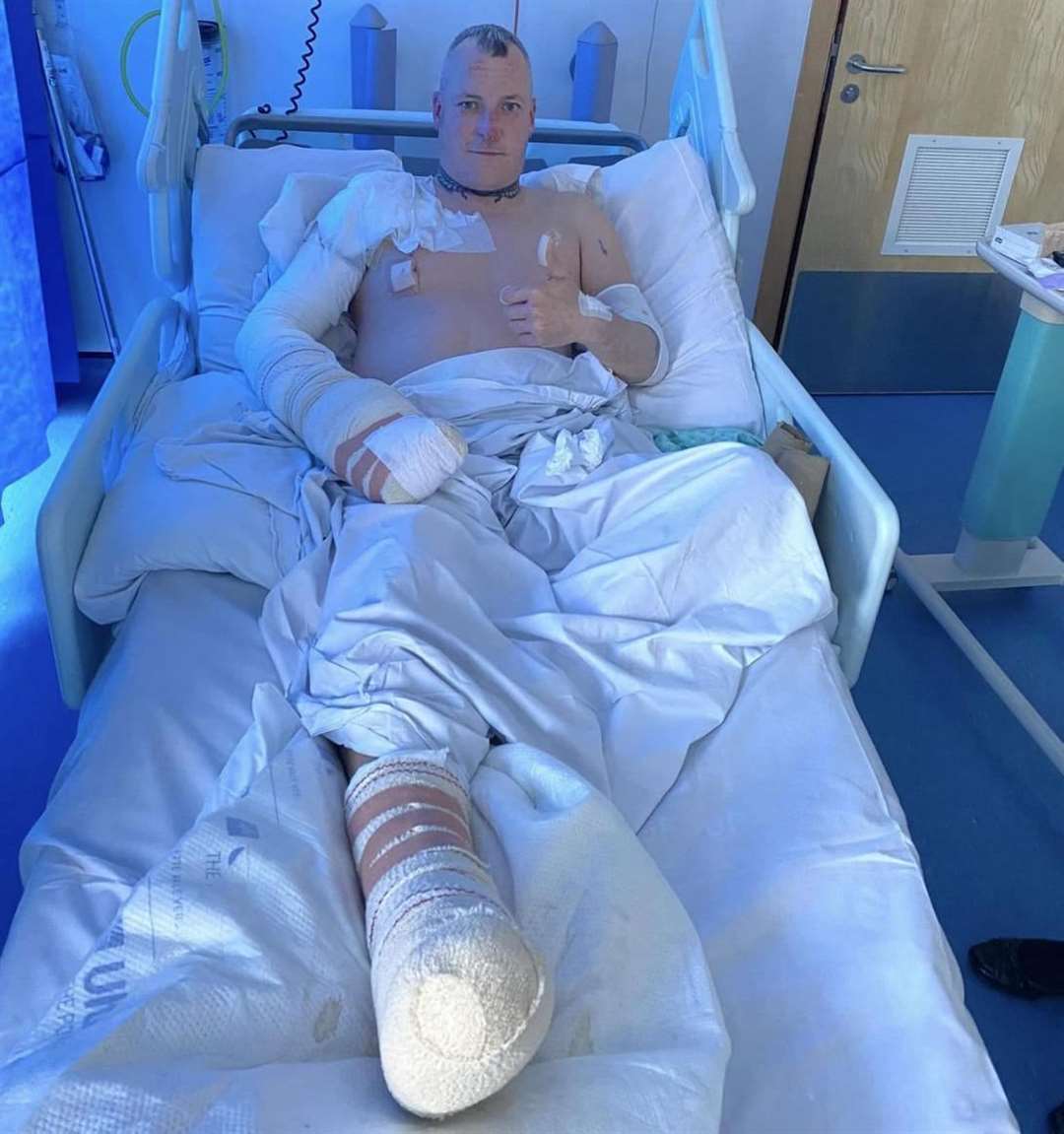 Kevin Record pictured from his hospital bed after suffering from life-changing burns. Picture: KFRS