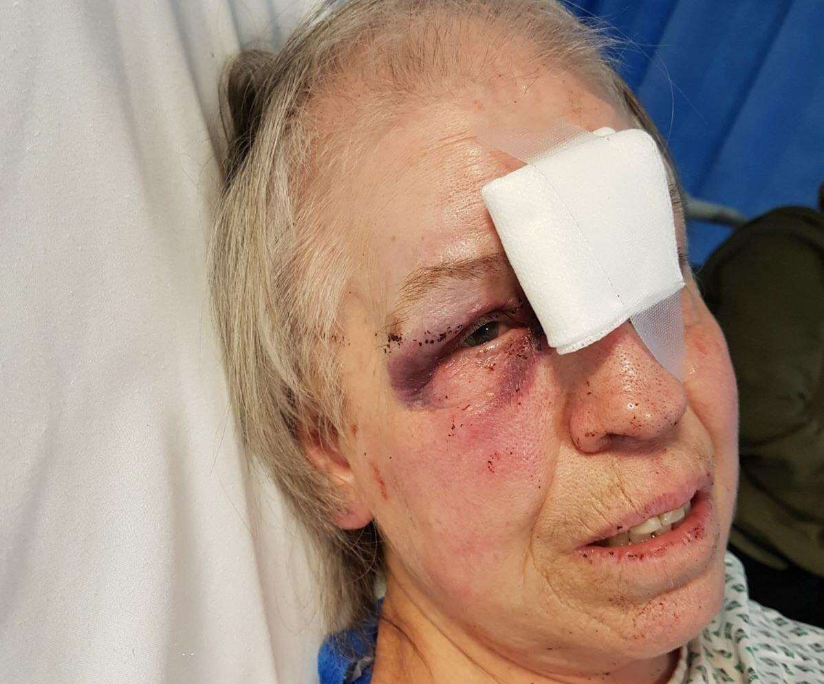 Lesley Wilson, 69, was punched and kicked when she had her handbag stolen (1941900)