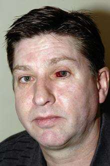 Nigel O'Brien who was targeted by yobs in Strood who threw an egg at him