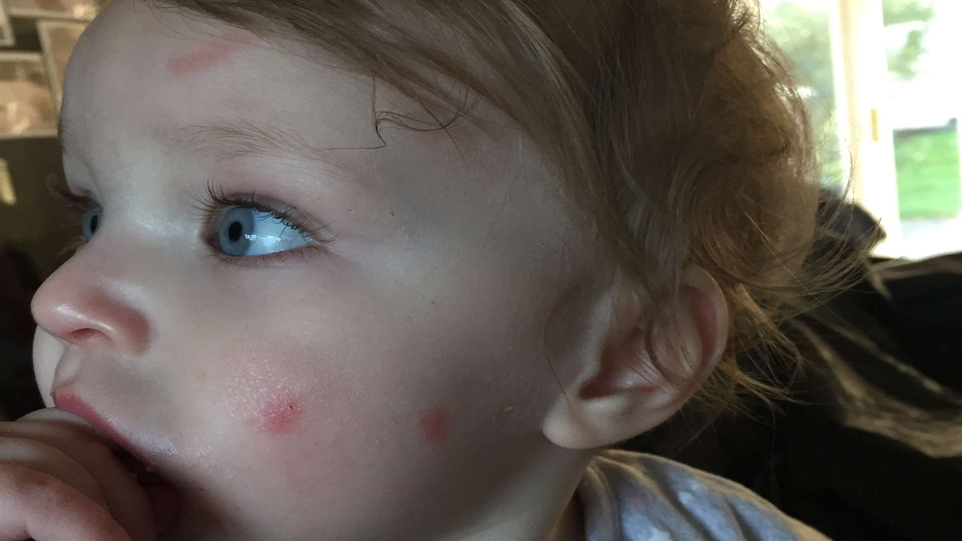 Amelia escaped with just a few scratches to her face when the tree branch crashed down onto the pushchair
